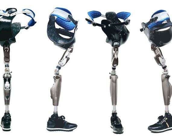 Nieuw type heupprothese: de Bikini Socket