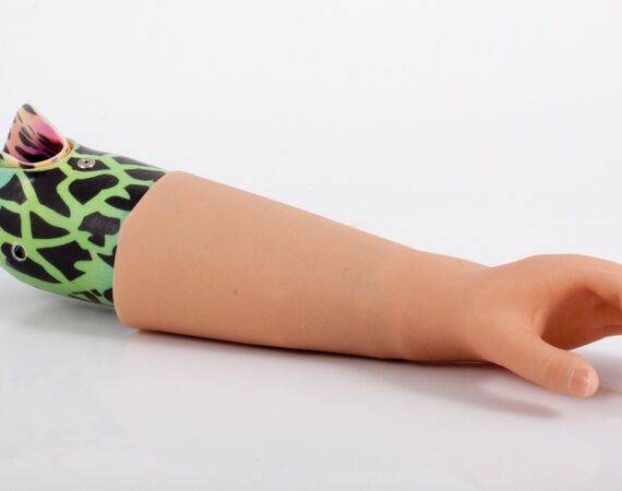 Armprothese inspiratie