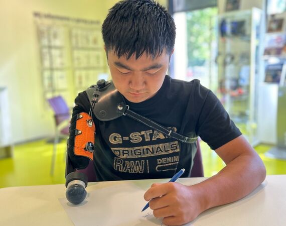 Xperience Prothese voor de bovenarm