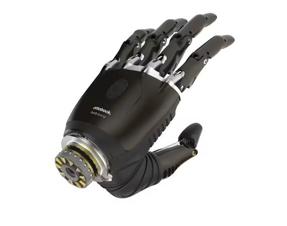 Zo blijven wij up-to-date in elektrische prothesehanden