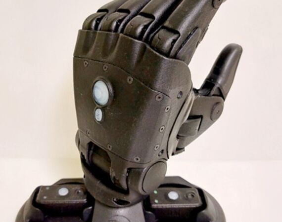 Zo blijven wij up-to-date in elektrische prothesehanden