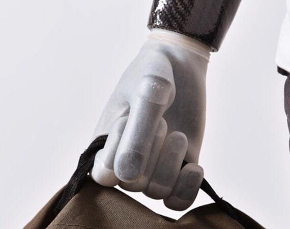 Zo blijven wij up-to-date in elektrische prothesehanden