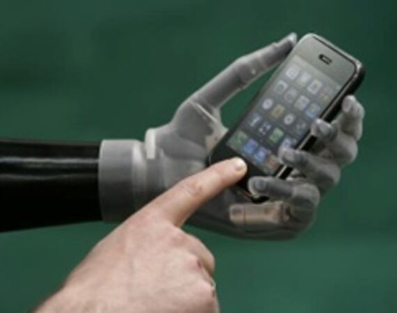 Zo blijven wij up-to-date in elektrische prothesehanden