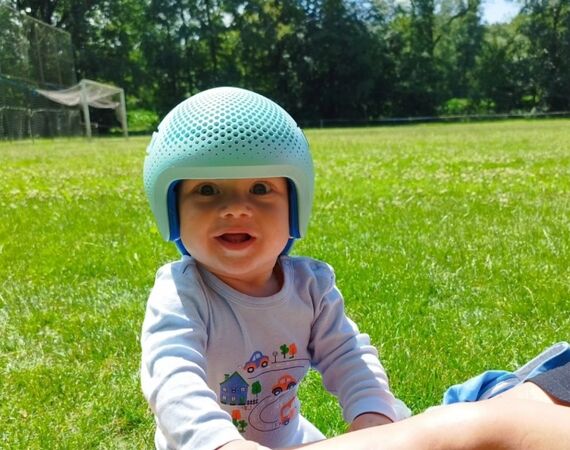 Postoperatieve redressiehelmen