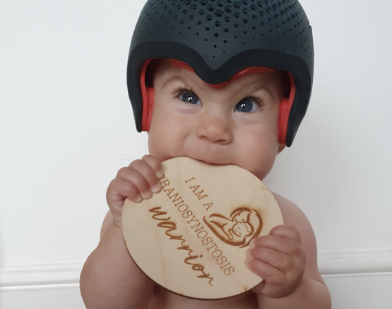 Postoperatieve redressiehelmen