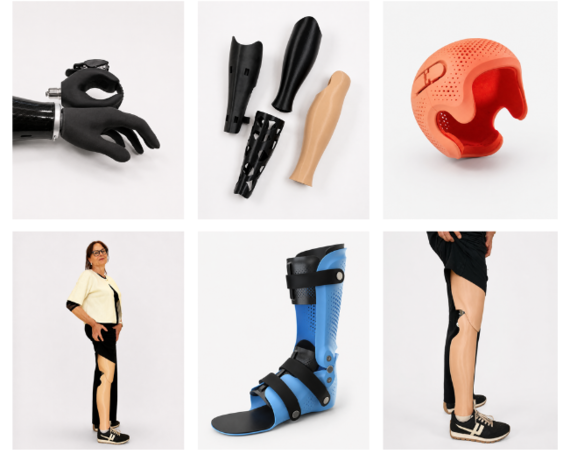 3D-printen binnen De Hoogstraat Orthopedietechniek