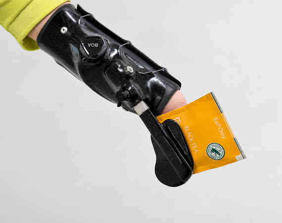 Handprothese