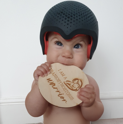 Postoperatieve redressiehelmen